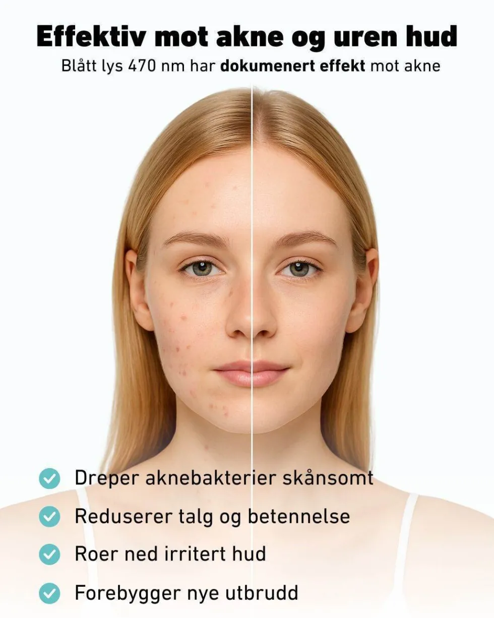 LED-lysmaske til ansikt mot akne, rynker og pigmentflekker